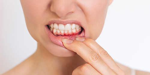 Was Sie über „Zahnfleischentzündungen“ wissen sollten!